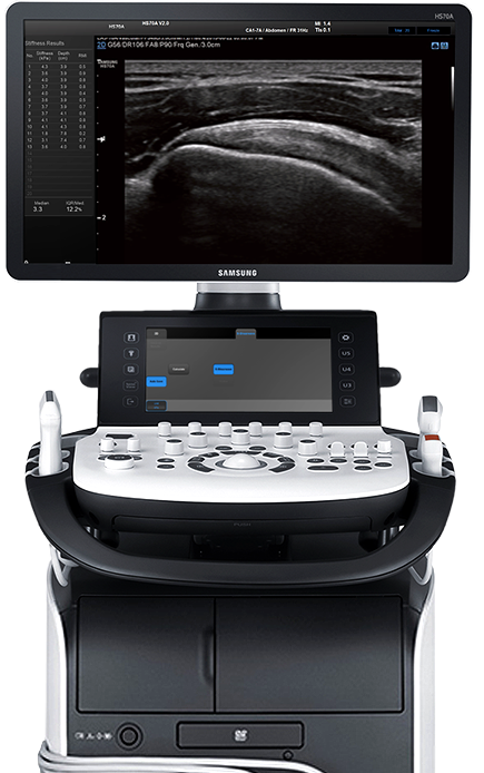 Medison ultrasound türkiye